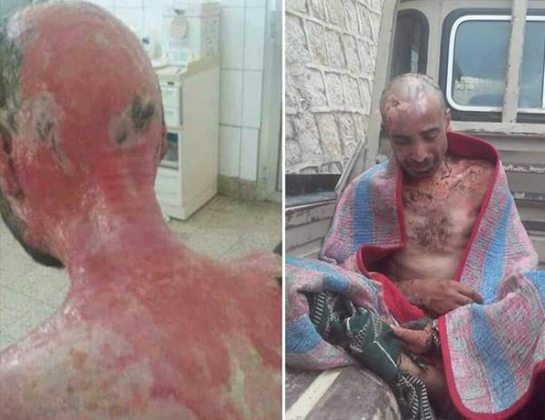 Yemen: UN Should Include the Issue of Torture Victims in the Mission of its Envoy to Save the Lives of Detainees